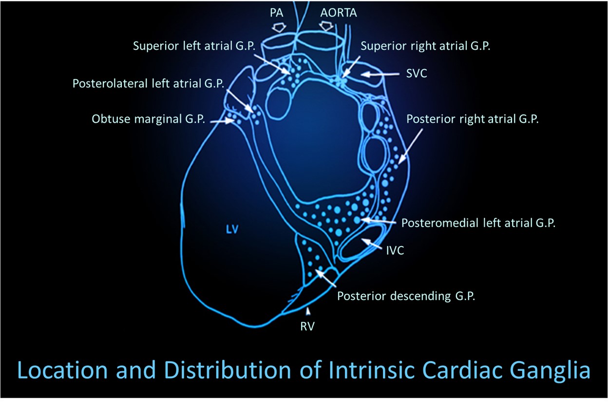 Intrinsic cardiac ganglia distribution